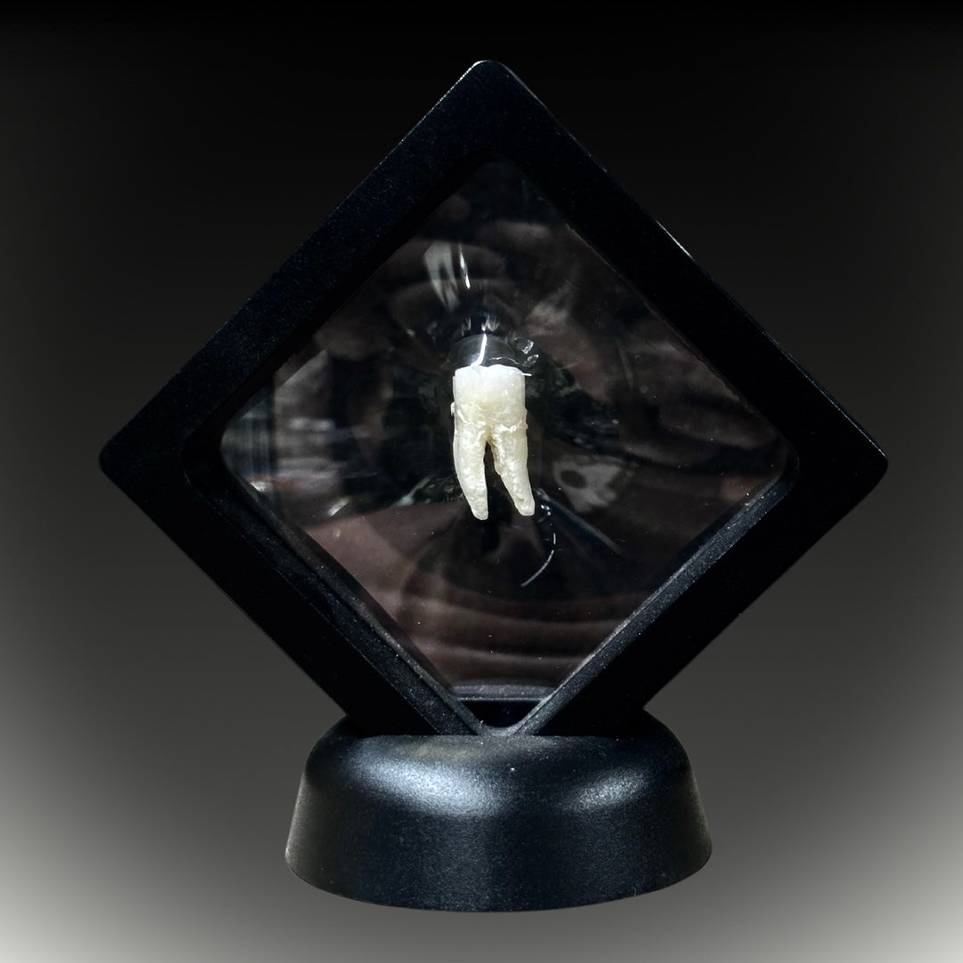 Framed Human Molar